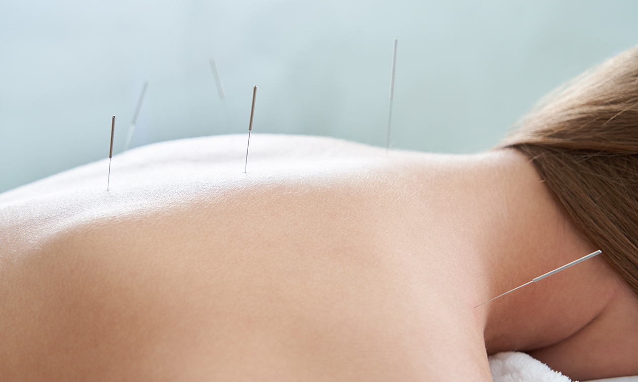 Acupunctuur Breda
