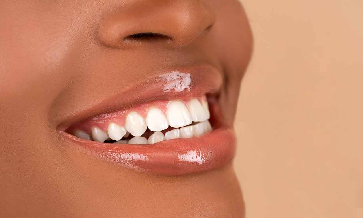 Big Smile Eindhoven