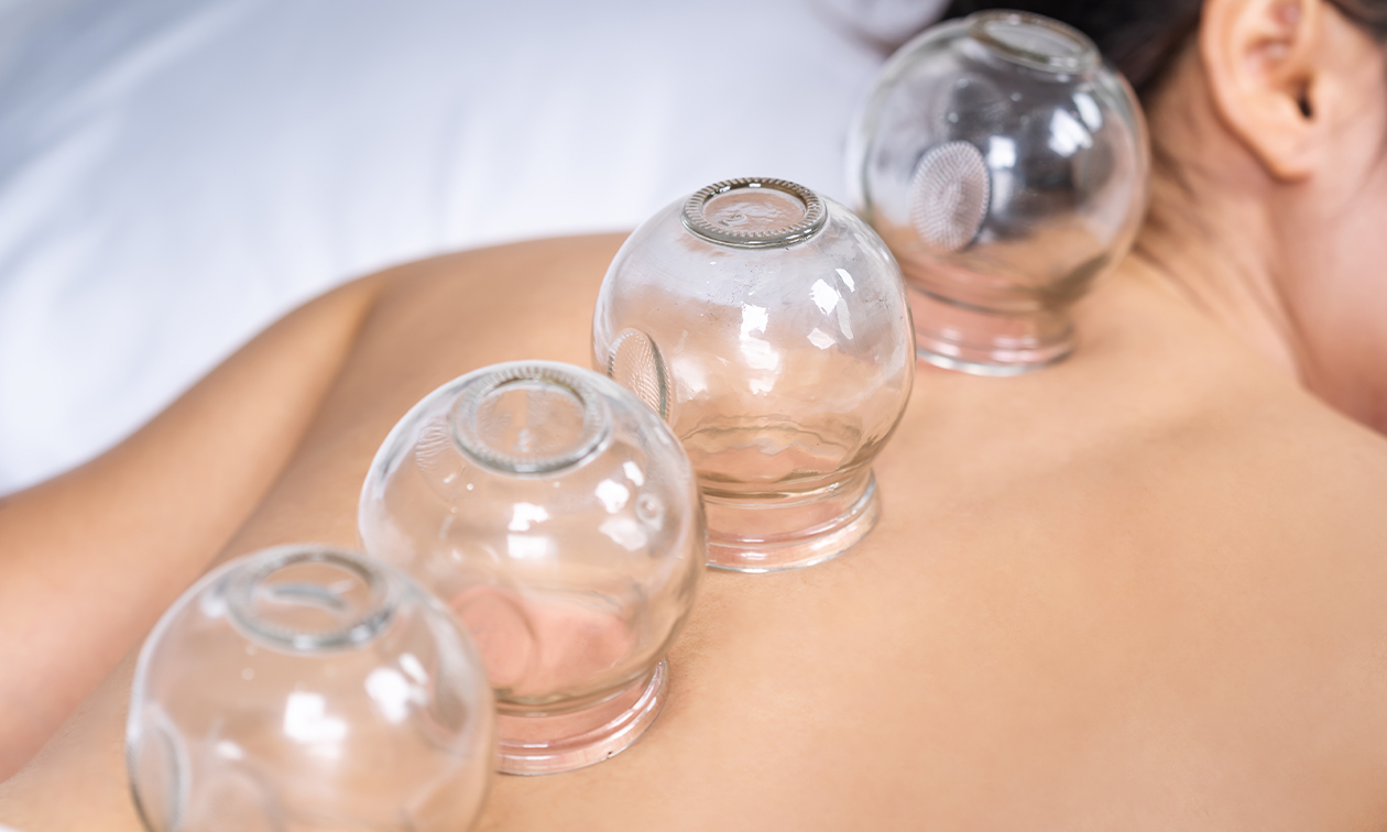 Cupping by Alysa