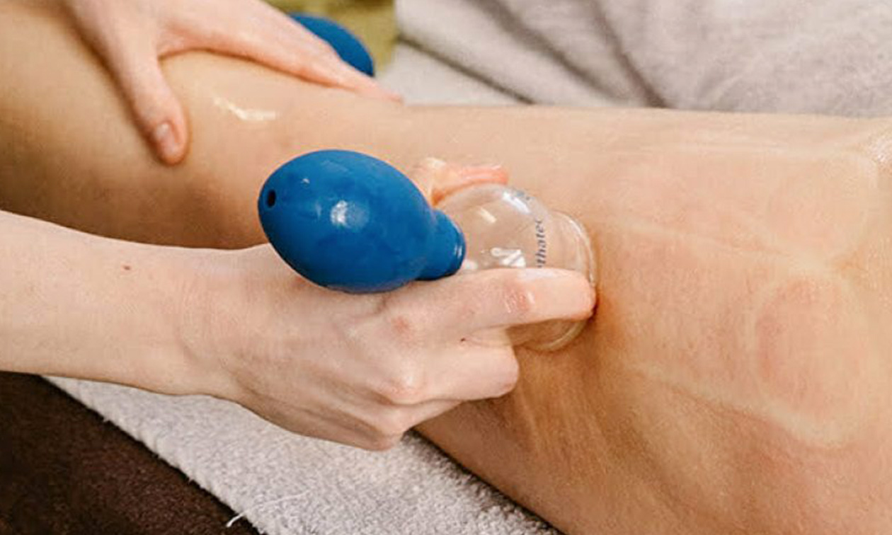 Beauty en cupping Drenthe