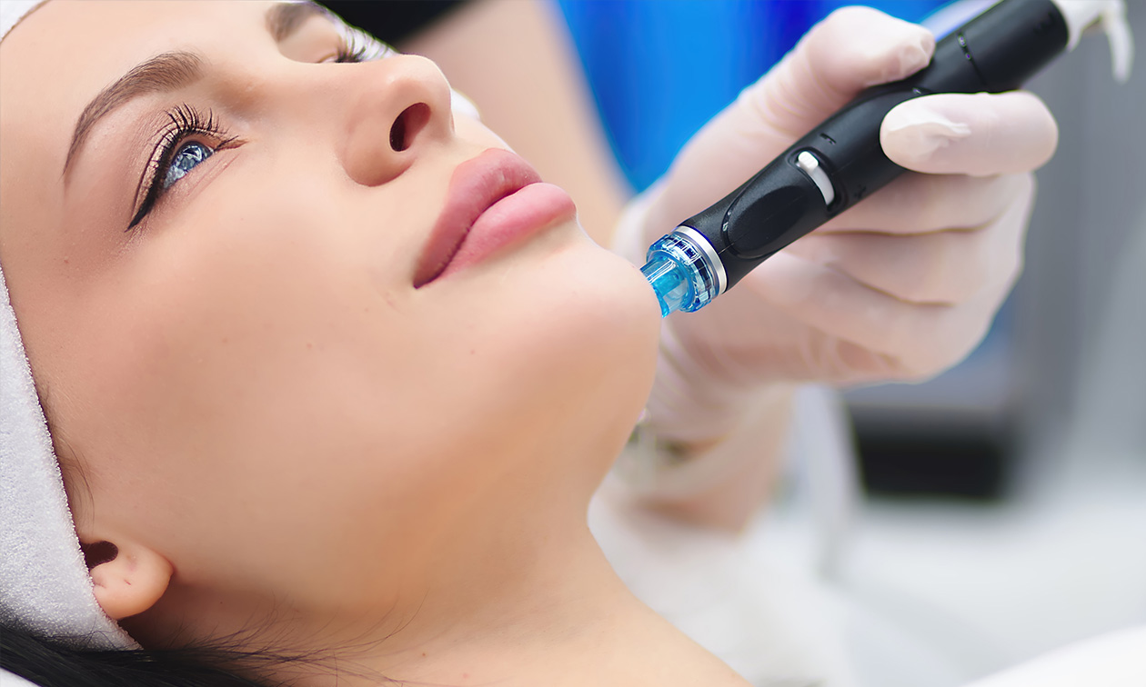 Laser Center Purmerend