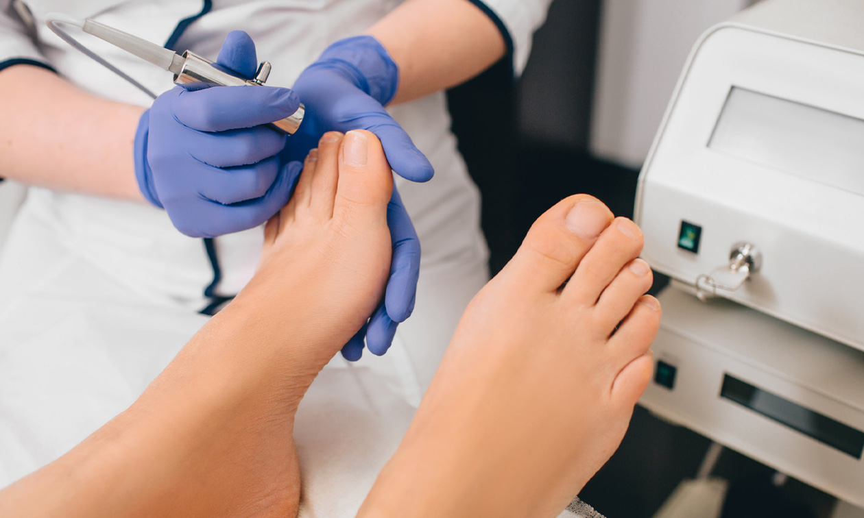 PinPointe Footlaser