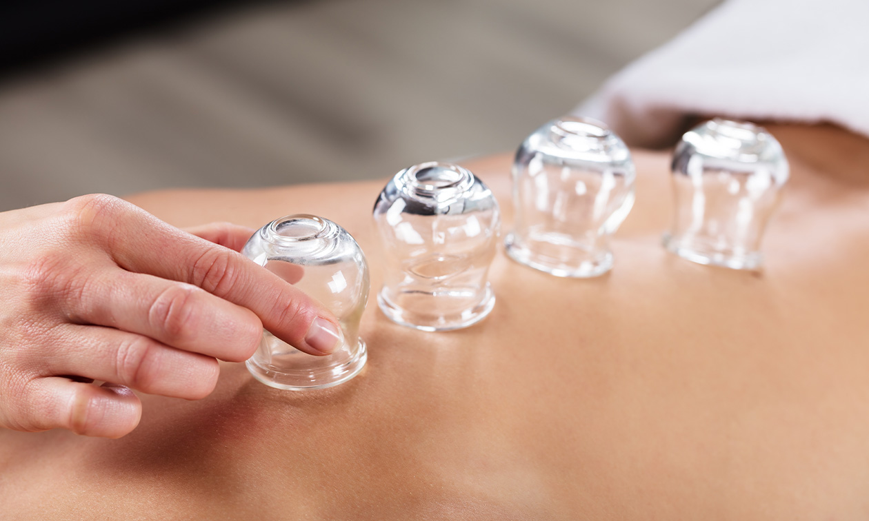 Transformational Cupping Soest - Marjan 't Lam