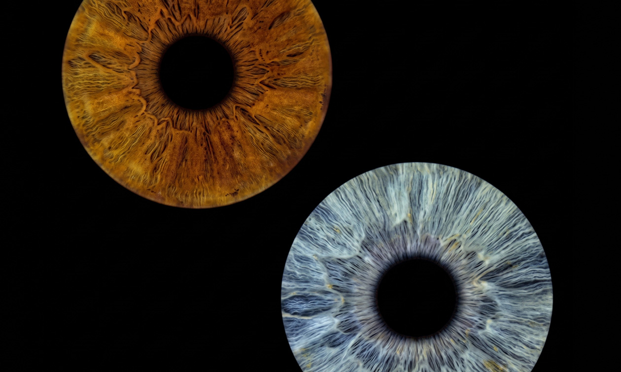 You & Eye Photo