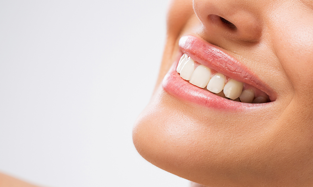 Tandenbleekbehandeling naar keuze