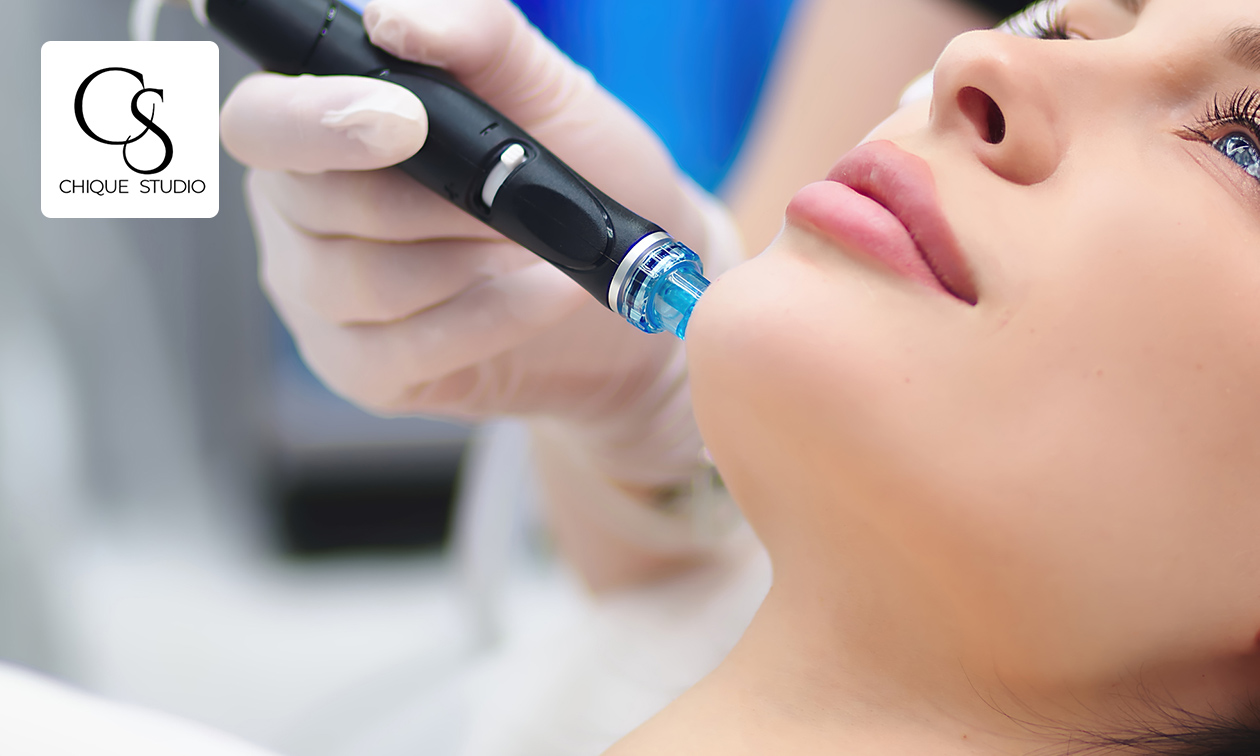 Microneedling en/of hydrofacial