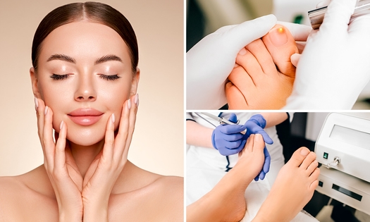 HIFU 25D Pro Max-faceliftbehandeling of 1 of 3 kalknagelbehandelingen