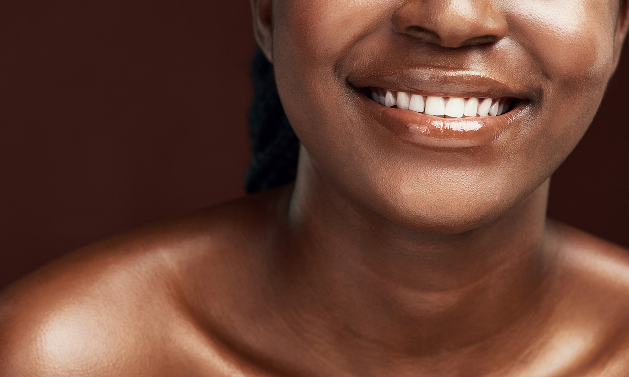 Séance de blanchiment dentaire (40, 60 ou 90 min) près de Liège