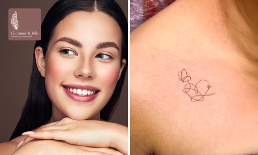 PMU-behandeling naar keuze of kleine tattoo