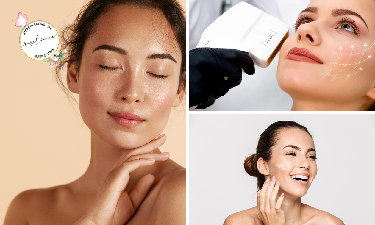 12D HIFU-behandeling voor zone(s) naar keuze