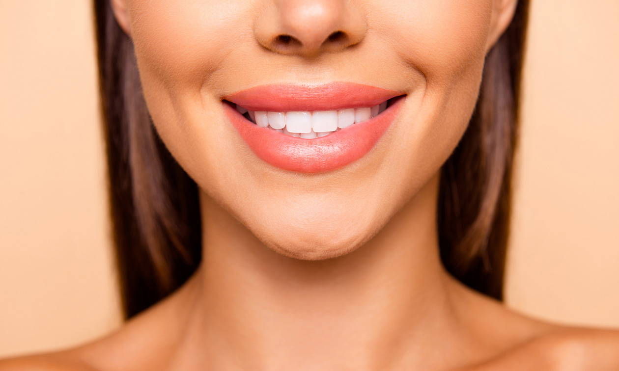 Tandenbleekbehandeling (30 of 60 min)