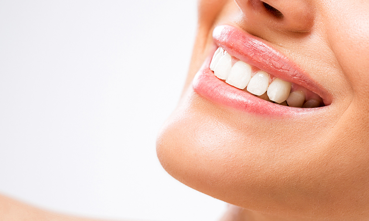 Banchiment dentaire White Touch (40 min) ou White Smile (2 x 40 min) à Liège